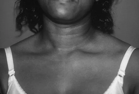 Upper Extremity 2008 Practice Questions: Set 5 (Solved) - Figure 14