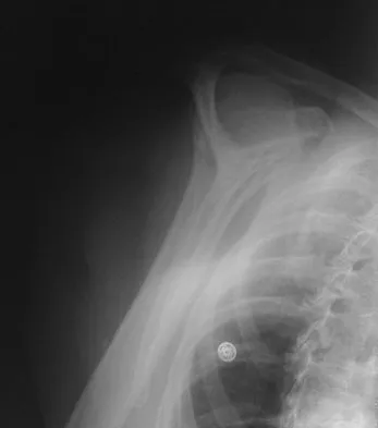 Upper Extremity 2008 Practice Questions: Set 5 (Solved) - Figure 2