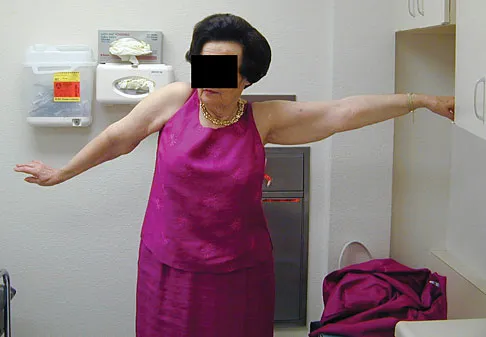 Upper Extremity 2008 Practice Questions: Set 5 (Solved) - Figure 3