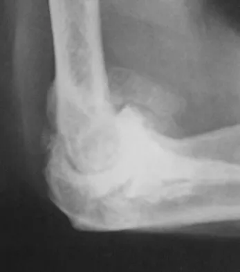 Upper Extremity 2008 Practice Questions: Set 5 (Solved) - Figure 5