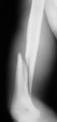 Upper Extremity 2008 Practice Questions: Set 5 (Solved) - Figure 6