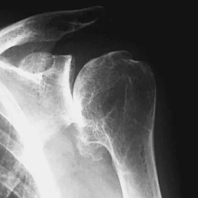 Upper Extremity 2008 Practice Questions: Set 5 (Solved) - Figure 7