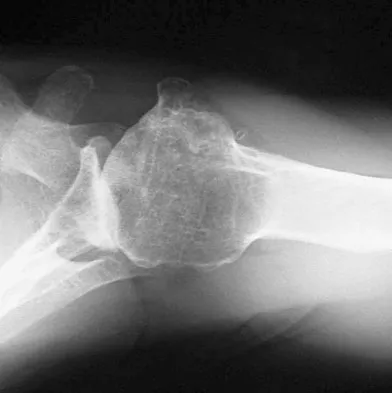 Upper Extremity 2008 Practice Questions: Set 5 (Solved) - Figure 8