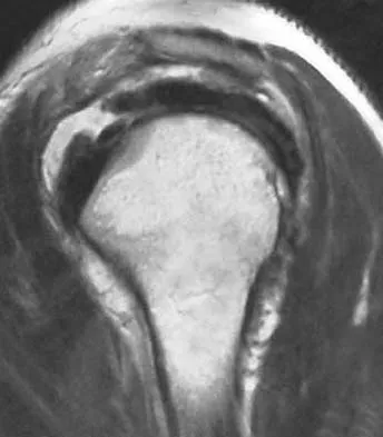 Upper Extremity 2026 MCQs: Board Review Questions & Answers (Part 1) - Figure 1