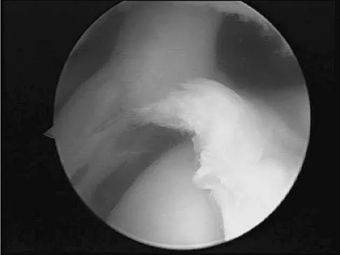 Upper Extremity 2026 MCQs: Board Review Questions & Answers (Part 1) - Figure 101