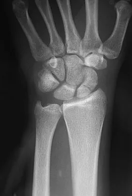 Upper Extremity 2026 MCQs: Board Review Questions & Answers (Part 1) - Figure 105