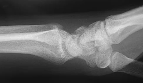 Upper Extremity 2026 MCQs: Board Review Questions & Answers (Part 1) - Figure 109