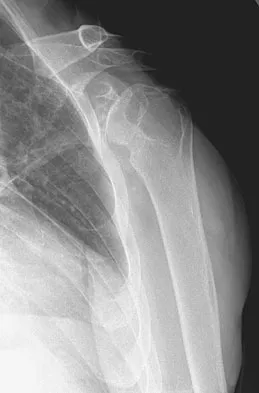 Upper Extremity 2026 MCQs: Board Review Questions & Answers (Part 1) - Figure 111
