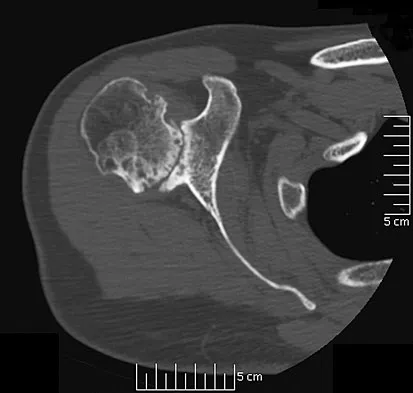 Upper Extremity 2026 MCQs: Board Review Questions & Answers (Part 1) - Figure 113