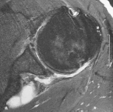 Upper Extremity 2026 MCQs: Board Review Questions & Answers (Part 1) - Figure 13