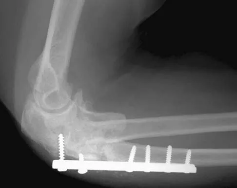 Upper Extremity 2026 MCQs: Board Review Questions & Answers (Part 1) - Figure 33
