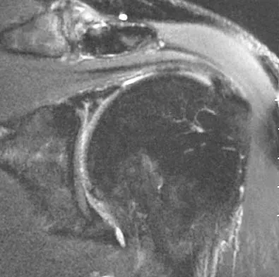 Upper Extremity 2026 MCQs: Board Review Questions & Answers (Part 1) - Figure 37