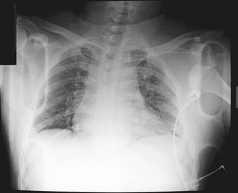 Upper Extremity 2026 MCQs: Board Review Questions & Answers (Part 1) - Figure 51