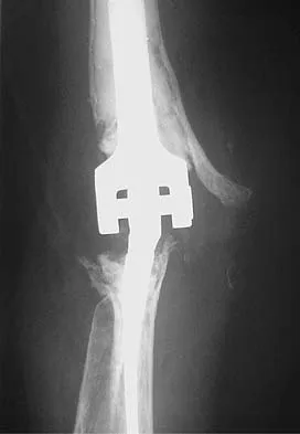 Upper Extremity 2026 MCQs: Board Review Questions & Answers (Part 1) - Figure 57