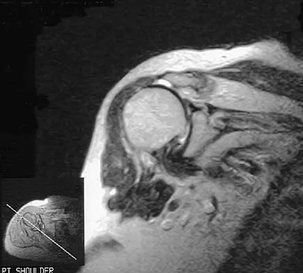 Upper Extremity 2026 MCQs: Board Review Questions & Answers (Part 1) - Figure 61