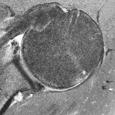 Upper Extremity 2026 MCQs: Board Review Questions & Answers (Part 1) - Figure 65