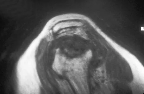 Upper Extremity 2026 MCQs: Board Review Questions & Answers (Part 1) - Figure 79