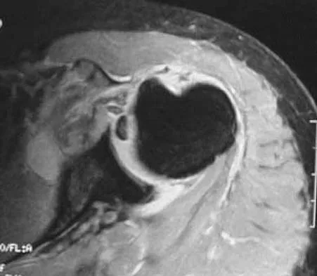 Upper Extremity 2026 MCQs: Board Review Questions & Answers (Part 1) - Figure 81