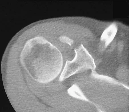 Upper Extremity 2026 MCQs: Board Review Questions & Answers (Part 1) - Figure 9