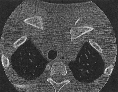 Upper Extremity 2026 MCQs: Board Review Questions & Answers (Part 1) - Figure 91