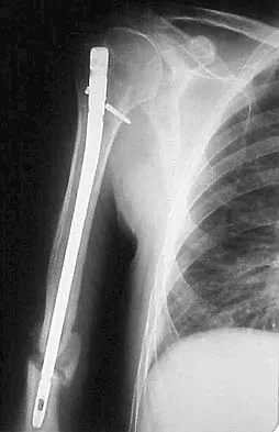 Upper Extremity 2026 MCQs: Board Review Questions & Answers (Part 2) - Figure 1