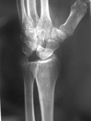 Upper Extremity 2026 MCQs: Board Review Questions & Answers (Part 2) - Figure 121