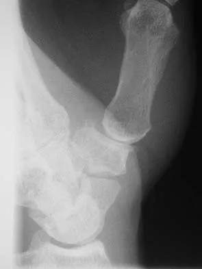 Upper Extremity 2026 MCQs: Board Review Questions & Answers (Part 2) - Figure 125