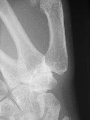 Upper Extremity 2026 MCQs: Board Review Questions & Answers (Part 2) - Figure 127