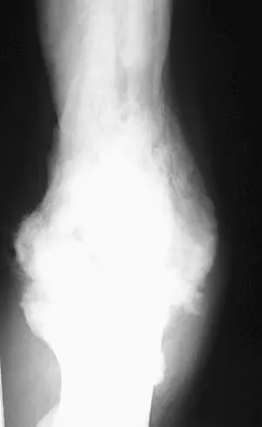 Upper Extremity 2026 MCQs: Board Review Questions & Answers (Part 2) - Figure 39