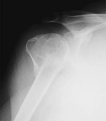 Upper Extremity 2026 MCQs: Board Review Questions & Answers (Part 2) - Figure 43