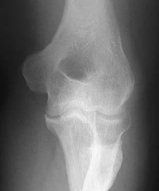 Upper Extremity 2026 MCQs: Board Review Questions & Answers (Part 2) - Figure 47