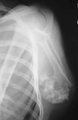 Upper Extremity 2026 MCQs: Board Review Questions & Answers (Part 2) - Figure 59