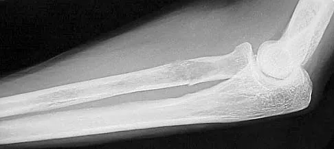 Upper Extremity 2026 MCQs: Board Review Questions & Answers (Part 2) - Figure 69