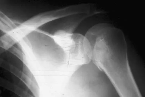 Upper Extremity 2026 MCQs: Board Review Questions & Answers (Part 3) - Figure 11