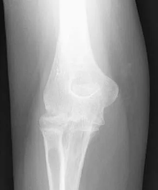 Upper Extremity 2026 MCQs: Board Review Questions & Answers (Part 3) - Figure 19