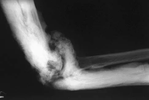 Upper Extremity 2026 MCQs: Board Review Questions & Answers (Part 3) - Figure 37