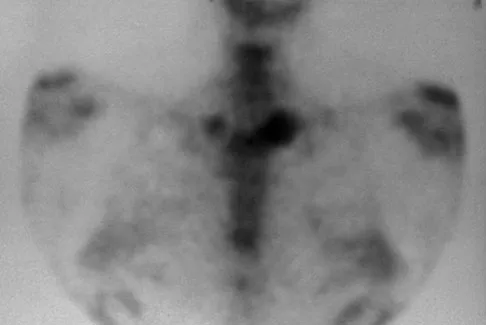 Upper Extremity 2026 MCQs: Board Review Questions & Answers (Part 3) - Figure 41