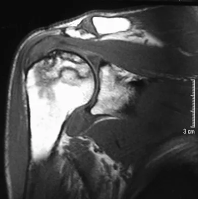 Upper Extremity 2026 MCQs: Board Review Questions & Answers (Part 3) - Figure 51