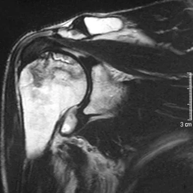 Upper Extremity 2026 MCQs: Board Review Questions & Answers (Part 3) - Figure 53