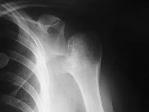 Upper Extremity 2026 MCQs: Board Review Questions & Answers (Part 3) - Figure 55