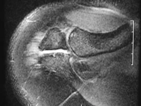 Upper Extremity 2026 MCQs: Board Review Questions & Answers (Part 3) - Figure 65