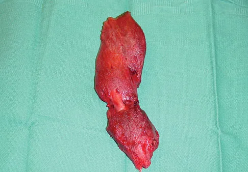 Upper Extremity 2026 MCQs: Board Review Questions & Answers (Part 3) - Figure 69