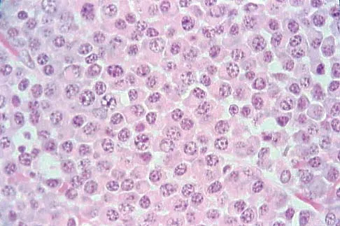 Upper Extremity 2026 MCQs: Board Review Questions & Answers (Part 4) - Figure 21