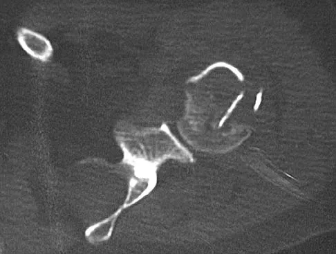 Upper Extremity 2026 MCQs: Board Review Questions & Answers (Part 4) - Figure 3