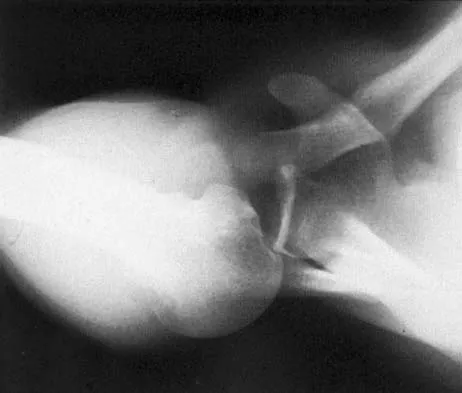 Upper Extremity 2026 MCQs: Board Review Questions & Answers (Part 4) - Figure 31