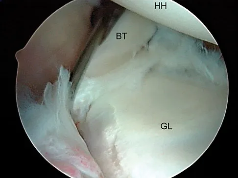 Upper Extremity 2026 MCQs: Board Review Questions & Answers (Part 4) - Figure 39