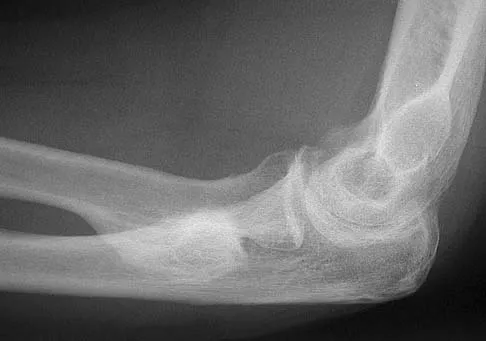 Upper Extremity 2026 MCQs: Board Review Questions & Answers (Part 4) - Figure 7