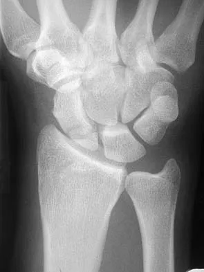Upper Extremity 2026 MCQs: Board Review Questions & Answers (Part 5) - Figure 1