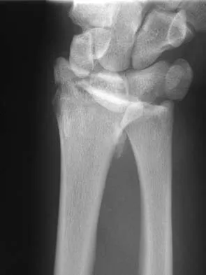 Upper Extremity 2026 MCQs: Board Review Questions & Answers (Part 5) - Figure 11
