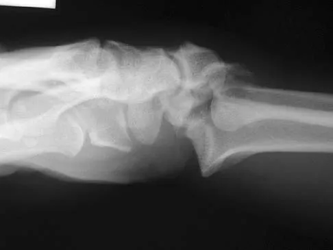 Upper Extremity 2026 MCQs: Board Review Questions & Answers (Part 5) - Figure 13